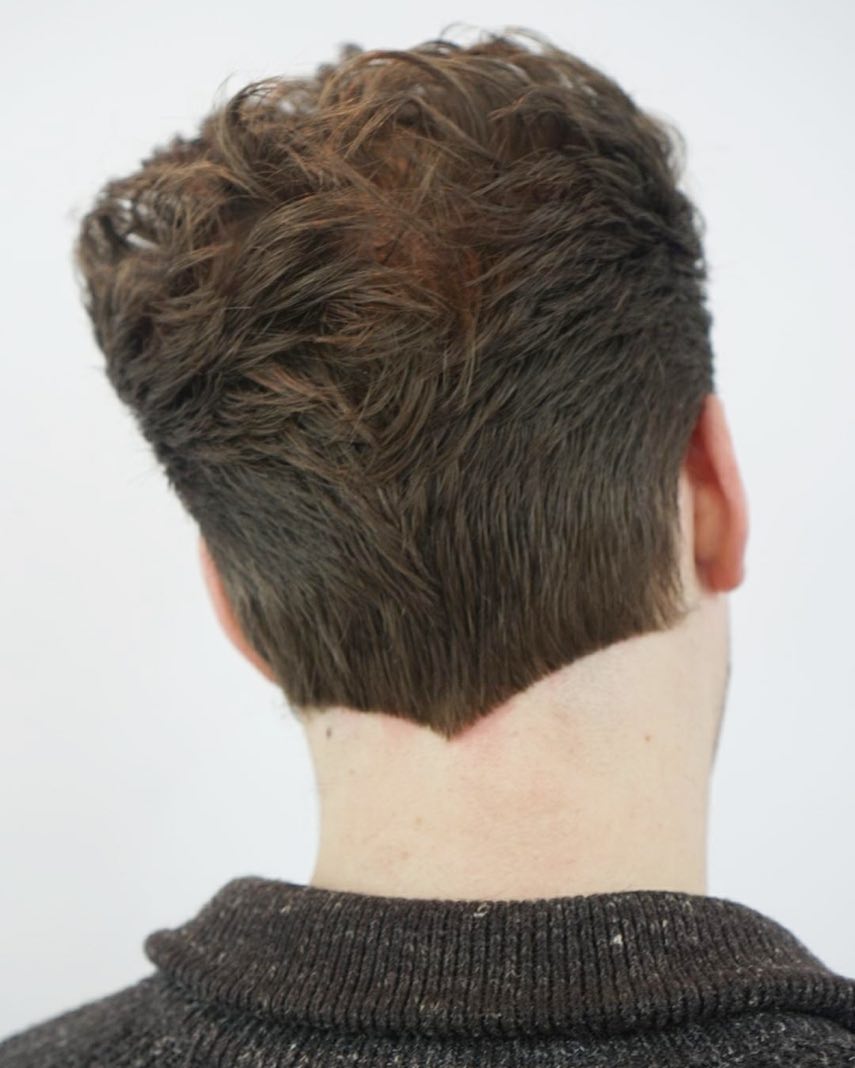 Líneas de cabello en forma de V para hombres