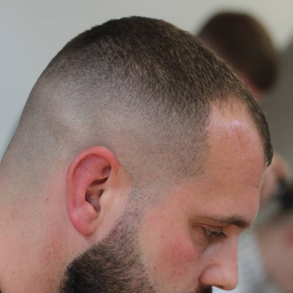 Haircuts for Balding Men -> Cool Styles That Work!