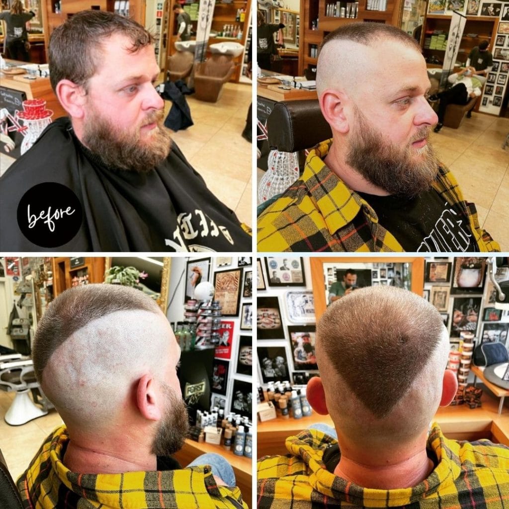 Cool haircuts for balding men