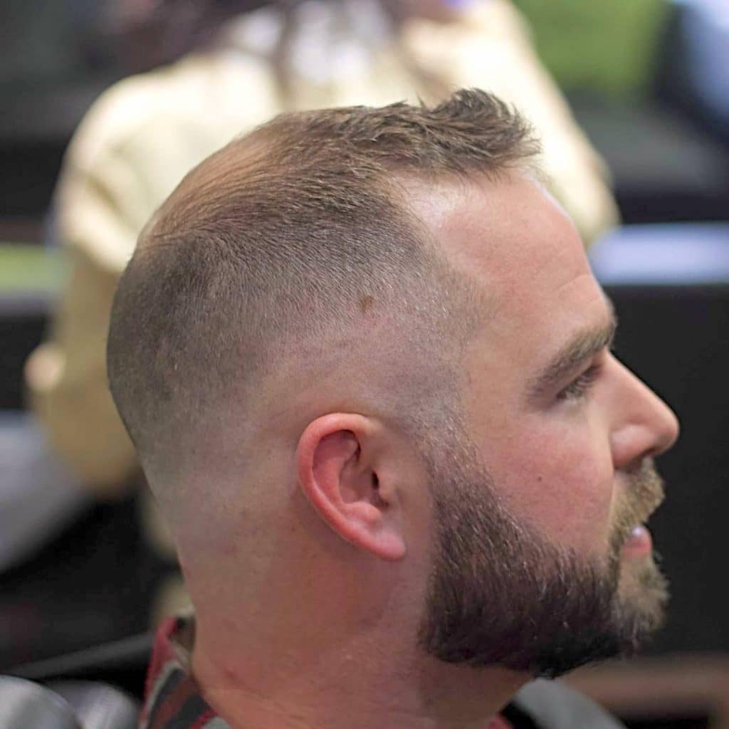 Best haircuts for bald spots men