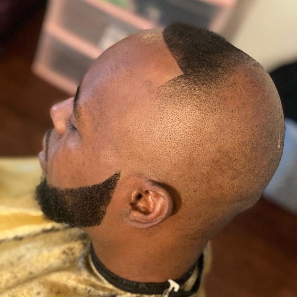 Receding hairline hair loss haircuts for Black men