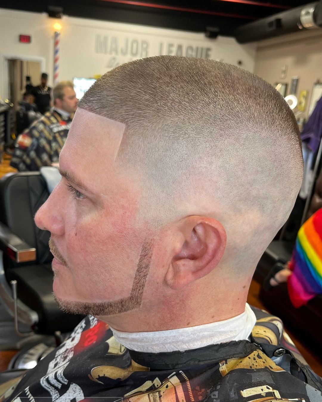 Buzz cut for alopecia